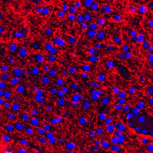 Anti -Myelin Basic Protein Rabbit pAb