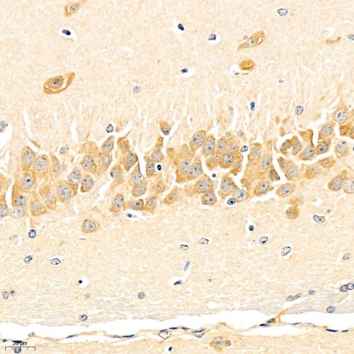 Anti -GCN2 Rabbit pAb