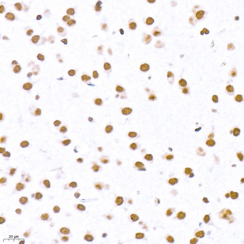 Anti -Topoisomerase II alpha Rabbit pAb