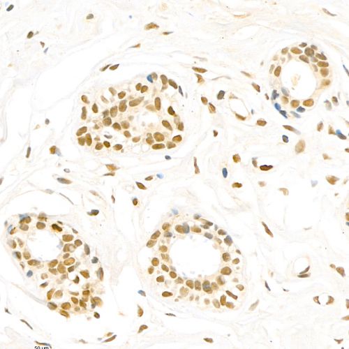 Anti -Topoisomerase II alpha Rabbit pAb